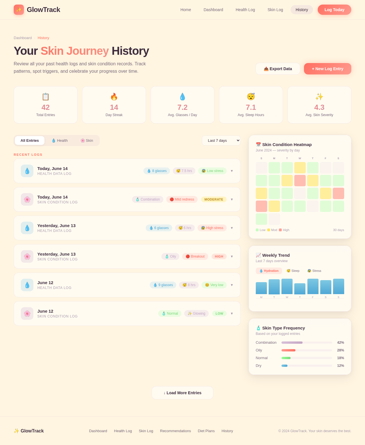 History design preview